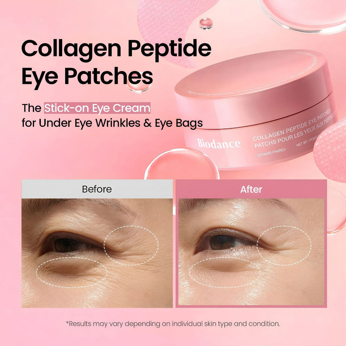 Diamond-Gel eye patches for fine lines puffiness and dry skin